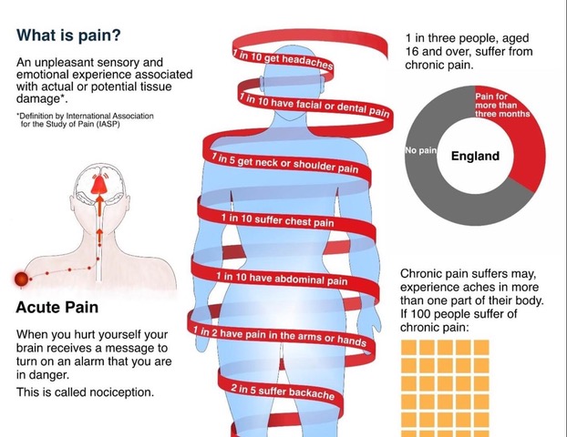 Visualising chronic pain.